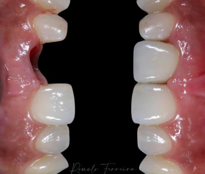 Foto 3 de Ortoestética Jaboatão