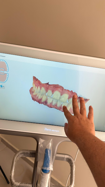 Foto 3 de Ortoestética Juazeiro | Dentista em Juazeiro Ba | Implantes dentários | Facetas | Clareamento | Invisalign doctor
