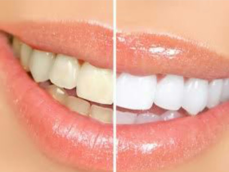 Foto 9 de Ortoestética Marco