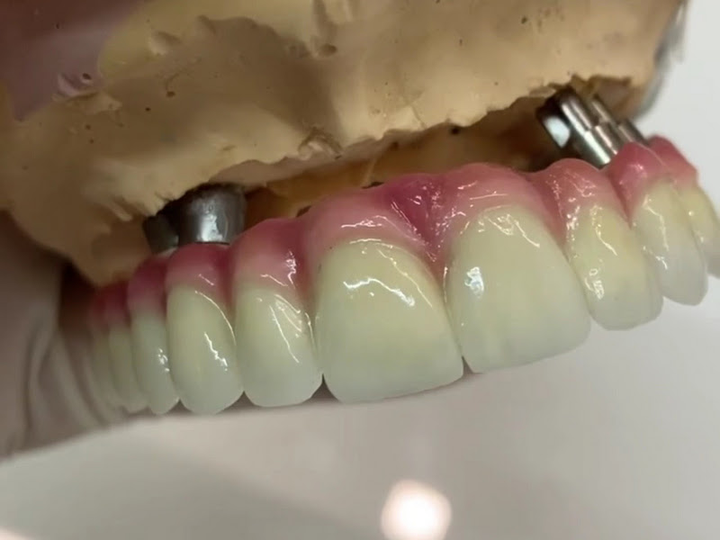 Foto 4 de Ortoface Batista Campos