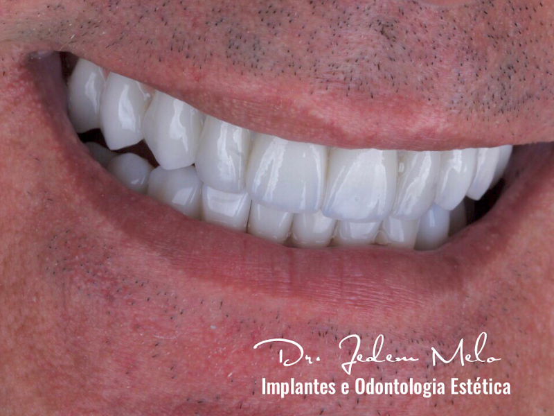 Foto 12 de Ortofácil Clínica Odontológica | Implantes dentários e Estética facial - Manaus/AM