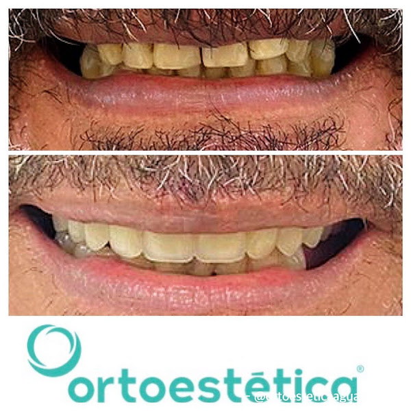Foto 3 de OrtoImplan | Odontologia e Implantes Dentários com Excelência!