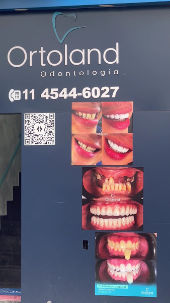 Foto 3 de Ortoland Odontologia | Dentista | Implantes | Ortodontia | Próteses