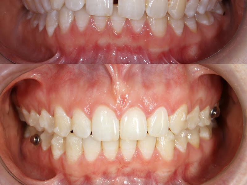 Foto 9 de Ortosmile Clínica Odontológica | Dentista no Santa Candida