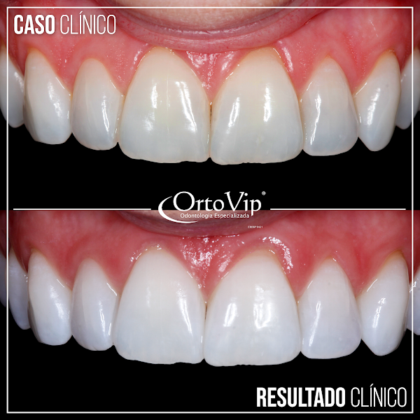 Foto 3 de Ortovip - Odontologia Especializada