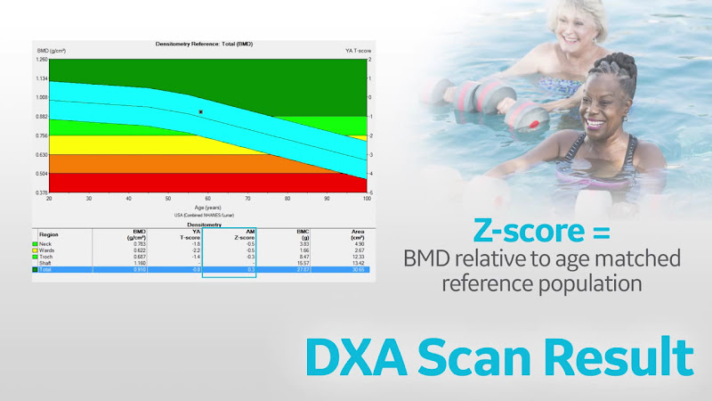 Foto 3 de OSTEOCLIN Clínica de Osteoporose e Densitometria Óssea
