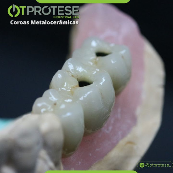 Foto 3 de OT Prótese Laboratório de Prótese Odontológica