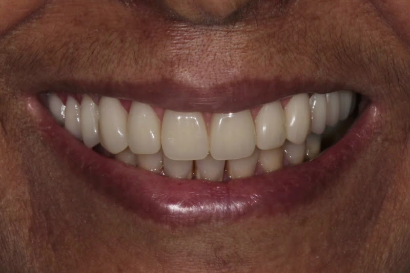 Foto 3 de OX Odontologia de Excelência | Lente de Contato | Implante | invisalign | Prótese | Protocolo | Dentista Campo Grande