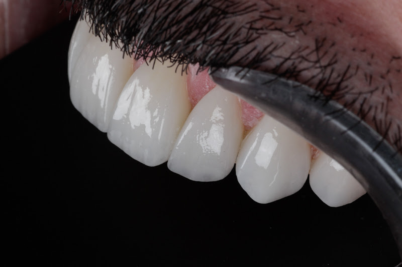 Foto 2 de Pacheco Odontologia Estética