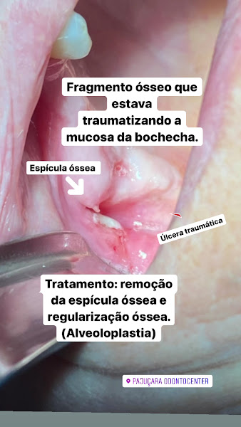 Foto 4 de Pajuçara Odontocenter