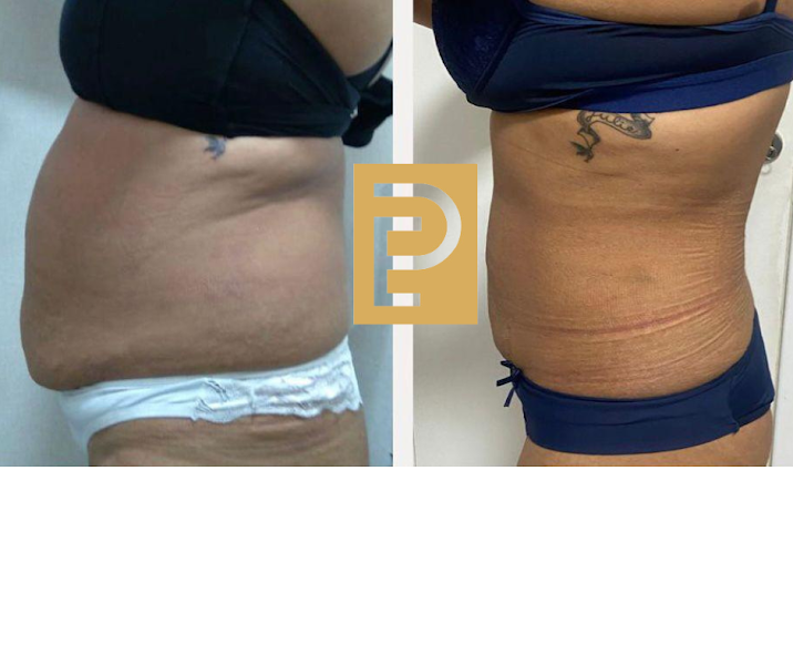 Foto 3 de Palladium Clínica Estética - Avenida Paulista - Metrô Brigadeiro