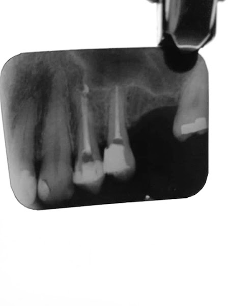 Foto 2 de Palmezan Odontologia