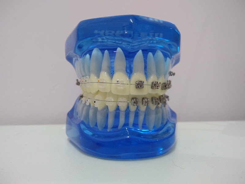 Foto 2 de Paloma Grazziottin - Ortodontia e estética