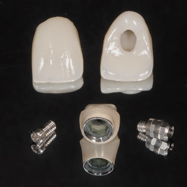 Foto 2 de PantojaBraga Odontologia