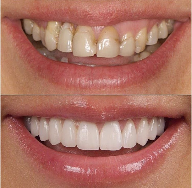 Foto 2 de Pase Odontologia e Estética