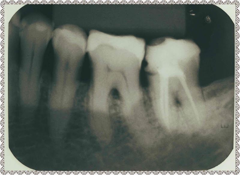 Foto 3 de Patrícia Lopes | Endodontia