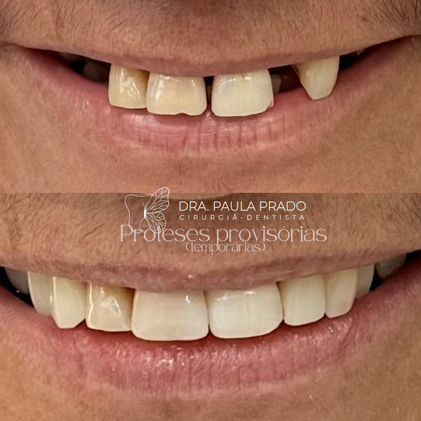 Foto 2 de Paula C. Prado Camarota - Dentista especialista em prótese dentária