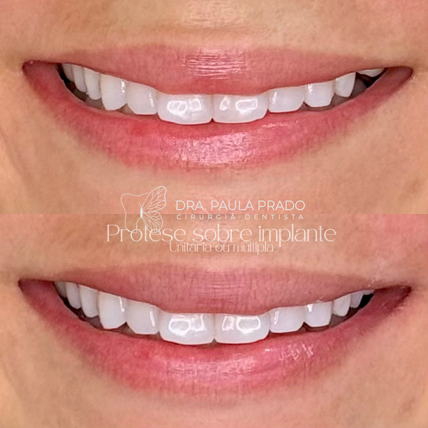 Foto 3 de Paula C. Prado Camarota - Dentista especialista em prótese dentária