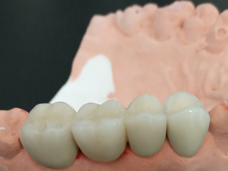 Foto 2 de Paulident Odontologia