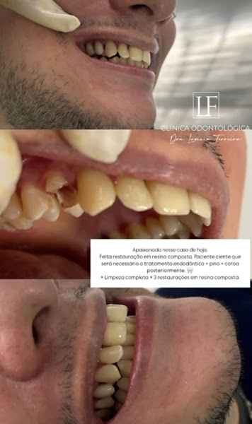 Foto 2 de Paulinho Protético - LS ODONTOLOGIA