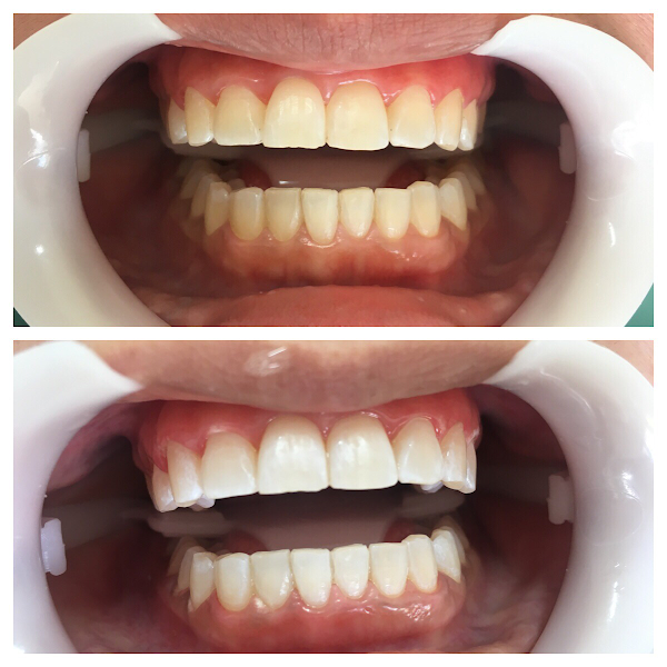 Foto 3 de Paulla Samara Odontologia