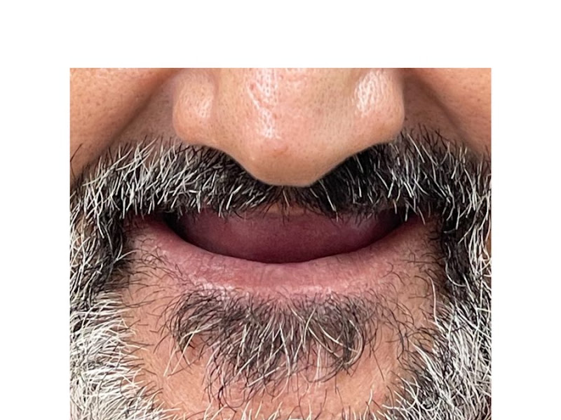 Foto 3 de Paulo Prótese Dentária
