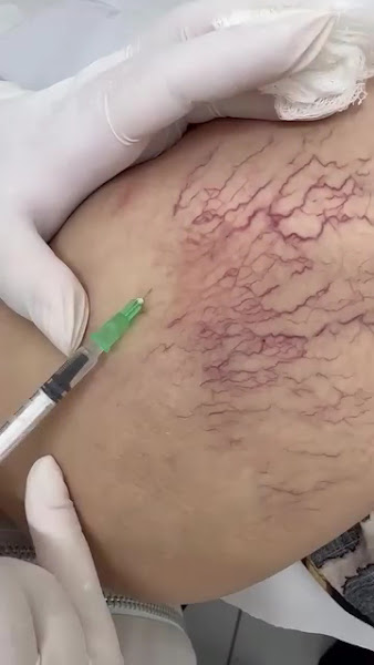 Foto 3 de Pelíssima Clinic