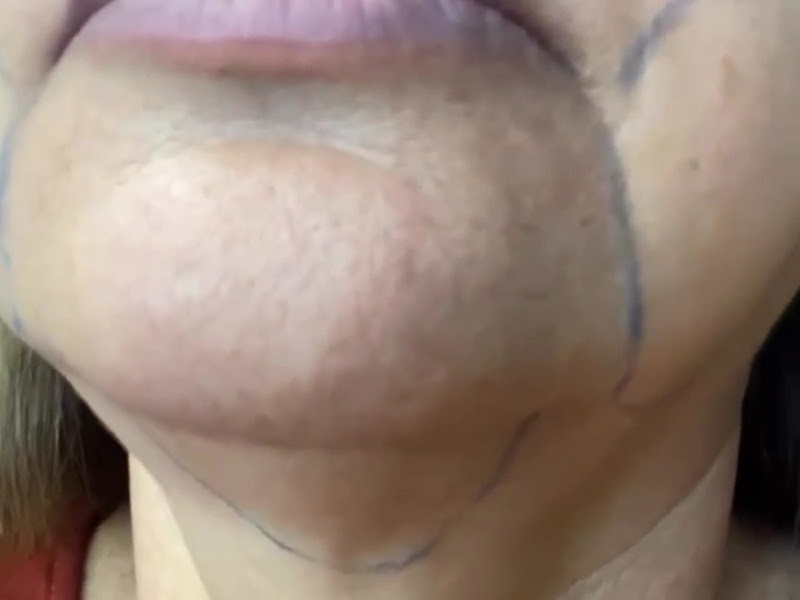 Foto 2 de Perface Odontologia e Harmonização Orofacial