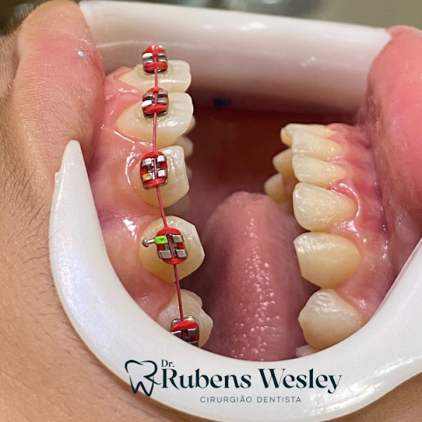 Foto 2 de Perfhace-Odontologia e Estética Personalizada
