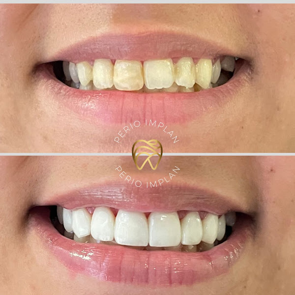 Foto 2 de Perio Implan - Odontologia Contagem