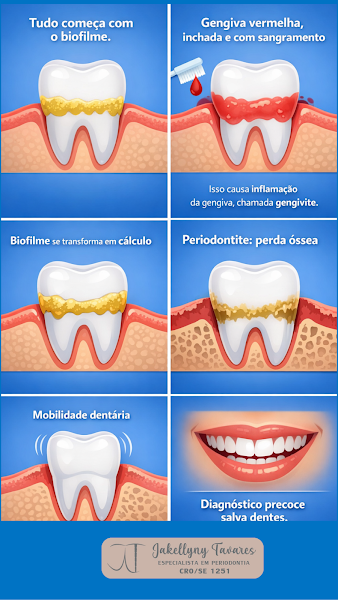 Foto 3 de Periodontista em Aracaju - Dra. Jakellyny Tavares | Saúde e Estética do Sorriso
