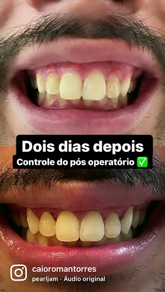 Foto 3 de Periodontista em Santos- Dr. Caio Roman Torres