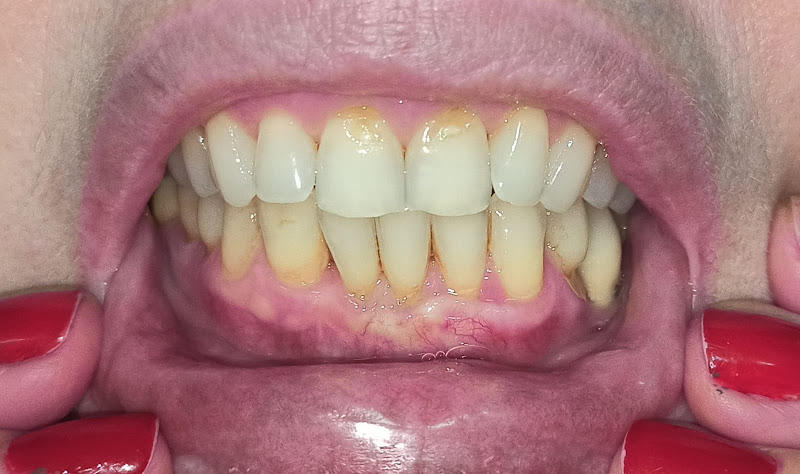 Foto 2 de Periodontista Londrina - Dra Bruna Landi