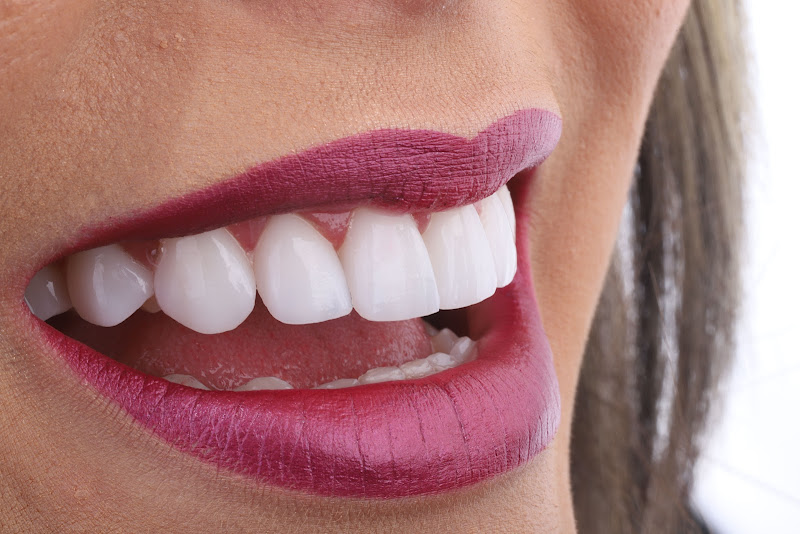 Foto 2 de Personal Odontologia Salvador