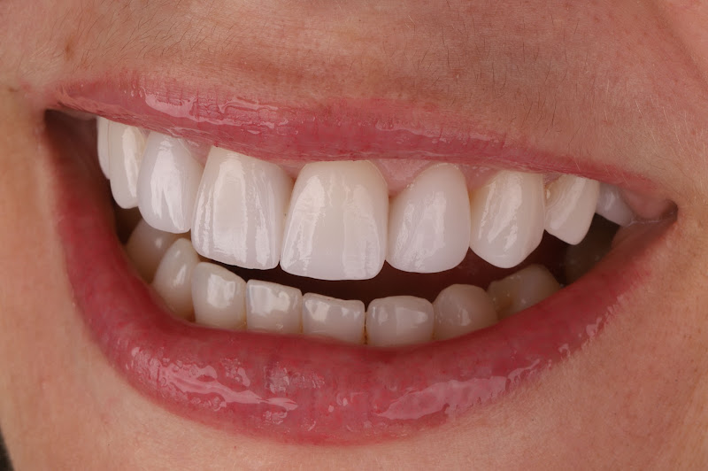 Foto 3 de Personal Odontologia Salvador