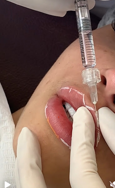 Foto 3 de Personalità Odontologia Especializada