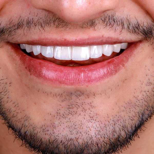 Foto 3 de Personalle Odontologia