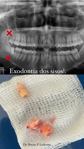 Foto 3 de Personnalite Odontologia