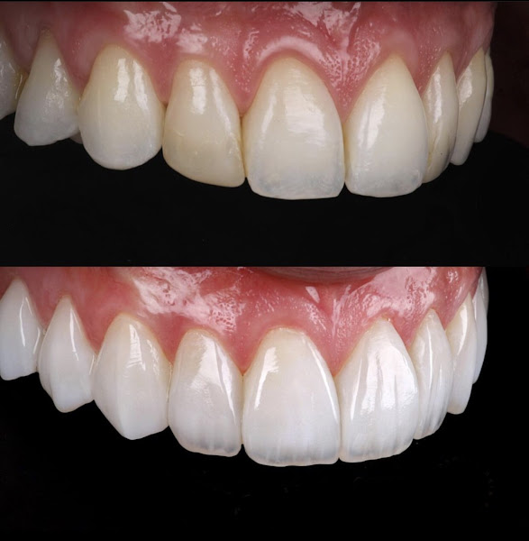 Foto 2 de Pettenazzi Odontologia e Estética