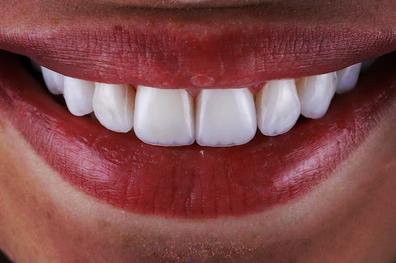 Foto 3 de Pettenazzi Odontologia e Estética