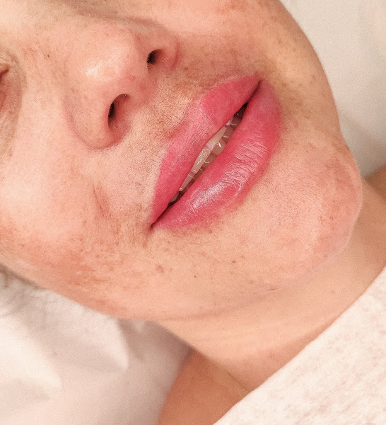 Foto 2 de Phigment Estética