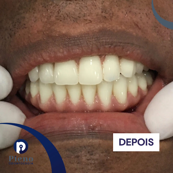 Foto 3 de Pieno Odontologia