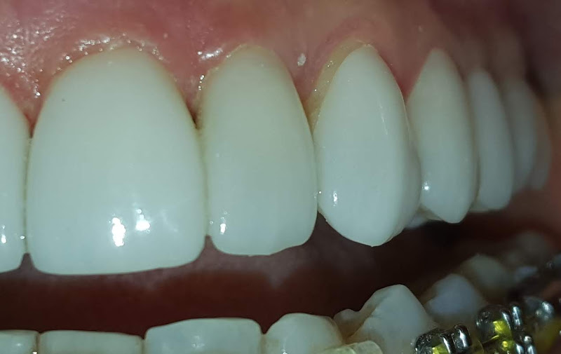 Foto 2 de Pillon Odontologia