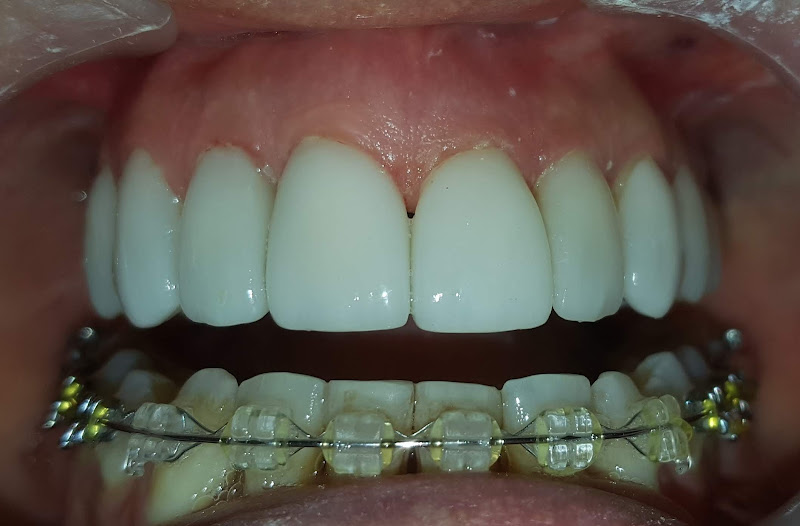 Foto 3 de Pillon Odontologia