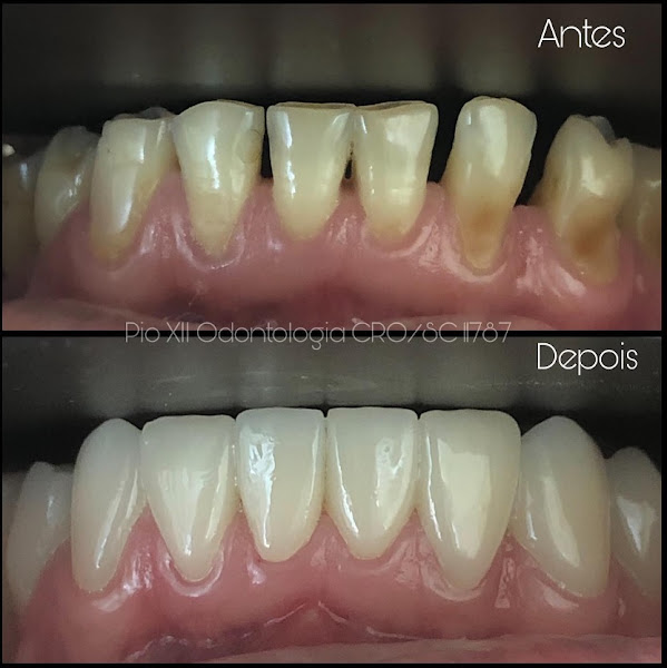 Foto de Pio Doze Odontologia | Especialistas em Reabilitação Oral