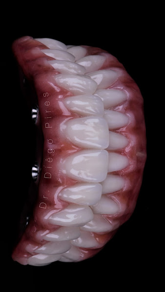 Foto 3 de Pireso Dental Clinic