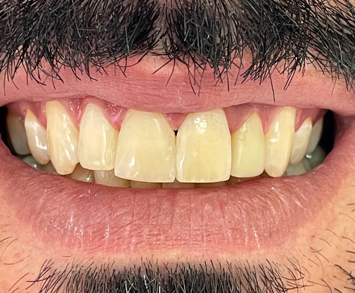 Foto 2 de Plantão Dentista Varginha. Dr Nichson. 24 h.