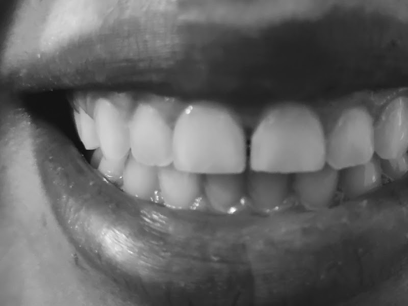 Foto 8 de Plenancy Odontologia Especializada