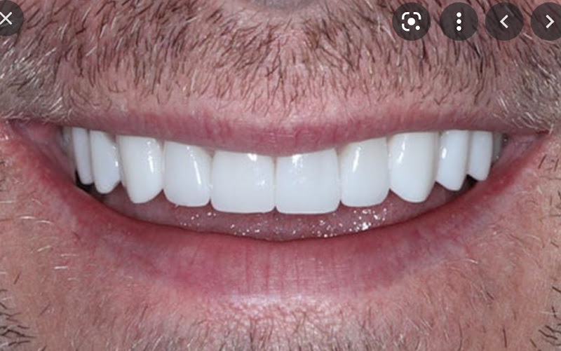 Foto 3 de PluLab - Laboratório de prótese especializado em lentes e facetas Dentais.