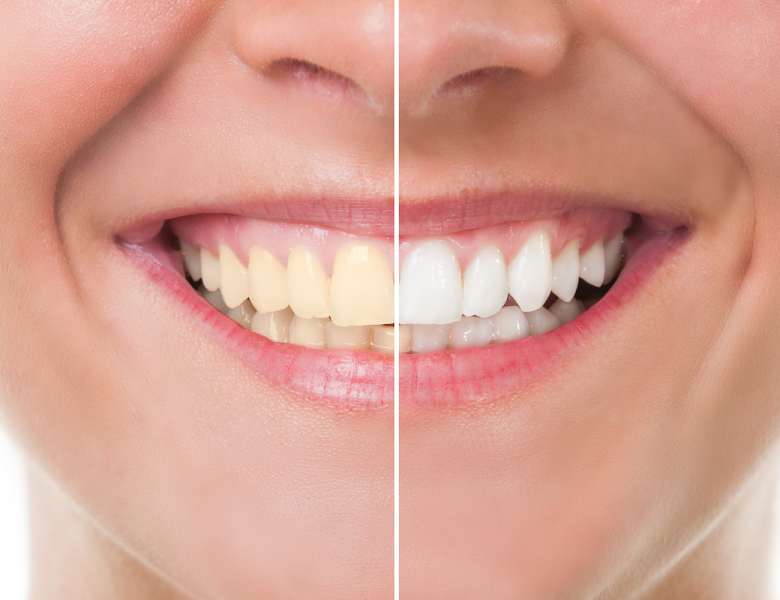 Foto 2 de Plus Life Odontologia Avançada BH